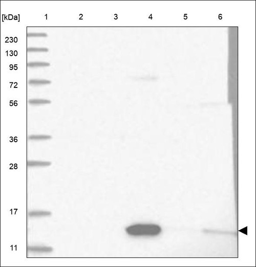 Lane 1: Marker [kDa] 230,130,95,72,56,36,28,17,11 Lane 2: RT4 Lane 3: U-251 MG Lane 4: Human Plasma Lane 5: Liver Lane 6: Tonsil