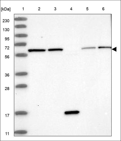 Lane 1: Marker [kDa] 230,130,95,72,56,36,28,17,11 Lane 2: RT4 Lane 3: U-251 MG Lane 4: Human Plasma Lane 5: Liver Lane 6: Tonsil