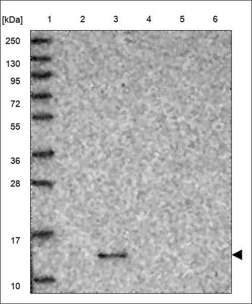 Lane 1: Marker [kDa] 250,130,95,72,55,36,28,17,10 Lane 2: RT4 Lane 3: U-251 MG Lane 4: Human Plasma Lane 5: Liver Lane 6: Tonsil