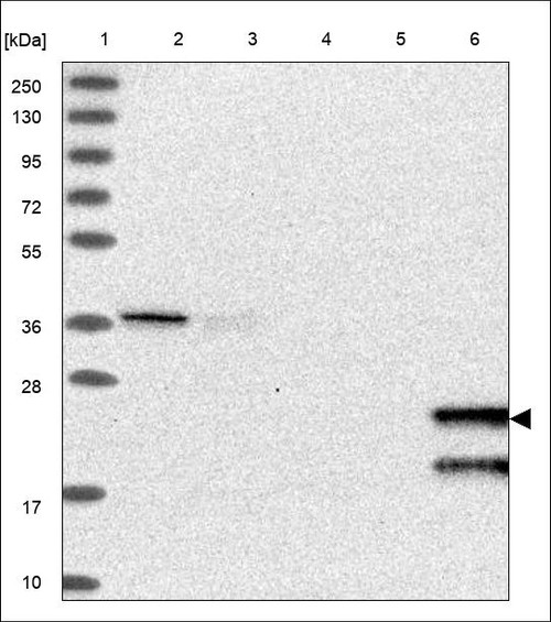 Lane 1: Marker [kDa] 250,130,95,72,55,36,28,17,10 Lane 2: RT4 Lane 3: U-251 MG Lane 4: Human Plasma Lane 5: Liver Lane 6: Tonsil
