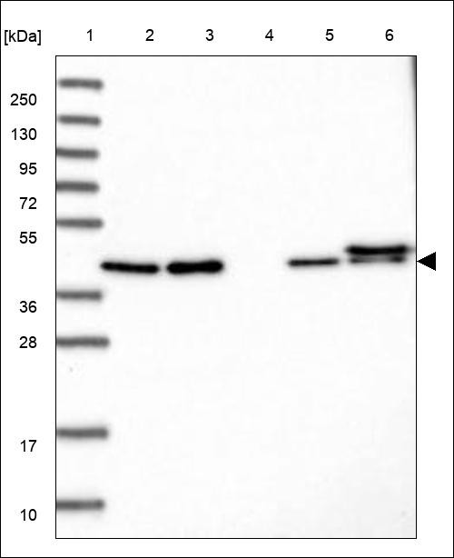 Lane 1: Marker [kDa] 250,130,95,72,55,36,28,17,10 Lane 2: RT4 Lane 3: U-251 MG Lane 4: Human Plasma Lane 5: Liver Lane 6: Tonsil