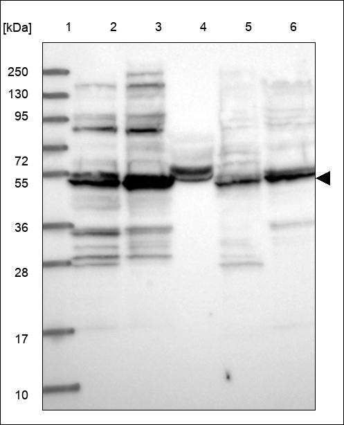 Lane 1: Marker [kDa] 250,130,95,72,55,36,28,17,10 Lane 2: RT4 Lane 3: U-251 MG Lane 4: Human Plasma Lane 5: Liver Lane 6: Tonsil