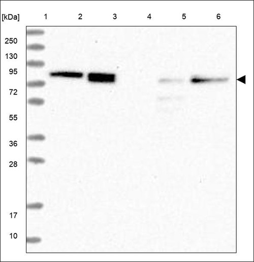 Lane 1: Marker [kDa] 250,130,95,72,55,36,28,17,10 Lane 2: RT4 Lane 3: U-251 MG Lane 4: Human Plasma Lane 5: Liver Lane 6: Tonsil