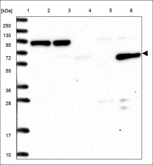 Lane 1: Marker [kDa] 250,130,95,72,55,36,28,17,10 Lane 2: RT4 Lane 3: U-251 MG Lane 4: Human Plasma Lane 5: Liver Lane 6: Tonsil