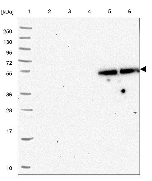 Lane 1: Marker [kDa] 250,130,95,72,55,36,28,17,10 Lane 2: RT4 Lane 3: U-251 MG Lane 4: Human Plasma Lane 5: Liver Lane 6: Tonsil