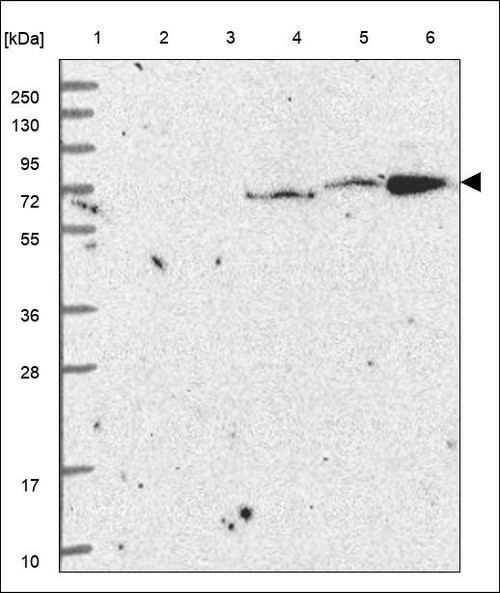 Lane 1: Marker [kDa] 250,130,95,72,55,36,28,17,10 Lane 2: RT4 Lane 3: U-251 MG Lane 4: Human Plasma Lane 5: Liver Lane 6: Tonsil