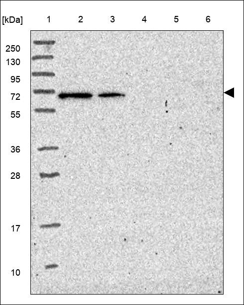 Lane 1: Marker [kDa] 250,130,95,72,55,36,28,17,10 Lane 2: RT4 Lane 3: U-251 MG Lane 4: Human Plasma Lane 5: Liver Lane 6: Tonsil