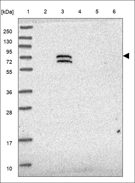 Lane 1: Marker [kDa] 250,130,95,72,55,36,28,17,10 Lane 2: RT4 Lane 3: U-251 MG Lane 4: Human Plasma Lane 5: Liver Lane 6: Tonsil