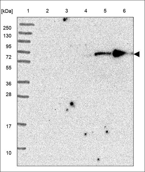 Lane 1: Marker [kDa] 250,130,95,72,55,36,28,17,10 Lane 2: RT4 Lane 3: U-251 MG Lane 4: Human Plasma Lane 5: Liver Lane 6: Tonsil