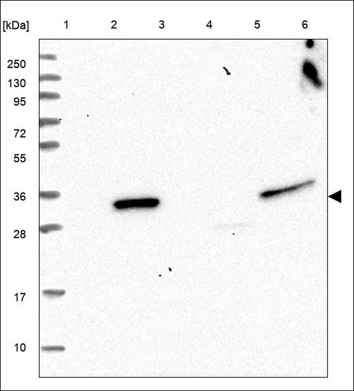 Lane 1: Marker [kDa] 250,130,95,72,55,36,28,17,10 Lane 2: RT4 Lane 3: U-251 MG Lane 4: Human Plasma Lane 5: Liver Lane 6: Tonsil