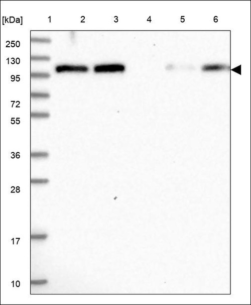 Lane 1: Marker [kDa] 250,130,95,72,55,36,28,17,10 Lane 2: RT4 Lane 3: U-251 MG Lane 4: Human Plasma Lane 5: Liver Lane 6: Tonsil