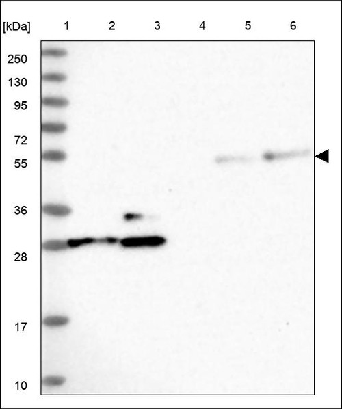 Lane 1: Marker [kDa] 250,130,95,72,55,36,28,17,10 Lane 2: RT4 Lane 3: U-251 MG Lane 4: Human Plasma Lane 5: Liver Lane 6: Tonsil