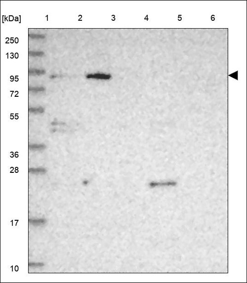 Lane 1: Marker [kDa] 250,130,95,72,55,36,28,17,10 Lane 2: RT4 Lane 3: U-251 MG Lane 4: Human Plasma Lane 5: Liver Lane 6: Tonsil