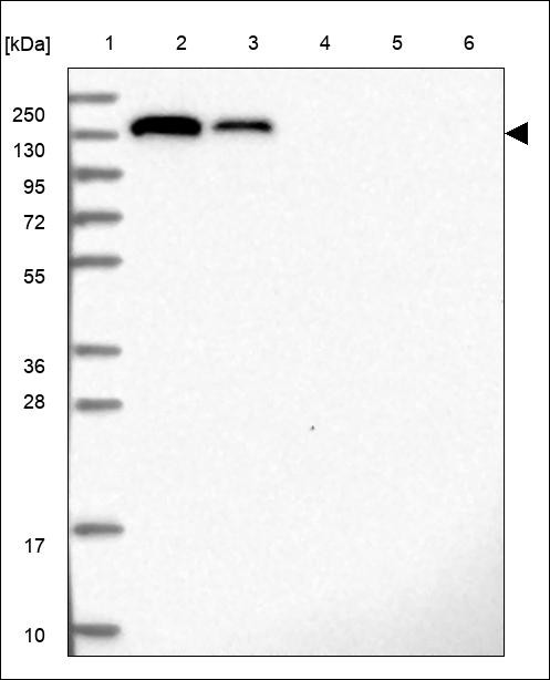 Lane 1: Marker [kDa] 250,130,95,72,55,36,28,17,10 Lane 2: RT4 Lane 3: U-251 MG Lane 4: Human Plasma Lane 5: Liver Lane 6: Tonsil