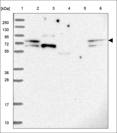 Lane 1: Marker [kDa] 250,130,95,72,55,36,28,17,10 Lane 2: RT4 Lane 3: U-251 MG Lane 4: Human Plasma Lane 5: Liver Lane 6: Tonsil