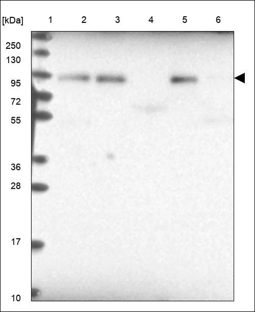 Lane 1: Marker [kDa] 250,130,95,72,55,36,28,17,10 Lane 2: RT4 Lane 3: U-251 MG Lane 4: Human Plasma Lane 5: Liver Lane 6: Tonsil
