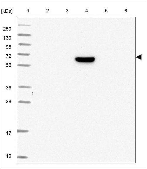 Lane 1: Marker [kDa] 250,130,95,72,55,36,28,17,10 Lane 2: RT4 Lane 3: U-251 MG Lane 4: Human Plasma Lane 5: Liver Lane 6: Tonsil