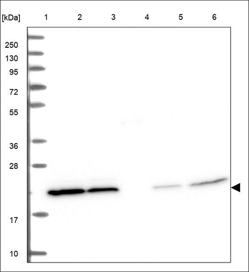Lane 1: Marker [kDa] 250,130,95,72,55,36,28,17,10 Lane 2: RT4 Lane 3: U-251 MG Lane 4: Human Plasma Lane 5: Liver Lane 6: Tonsil