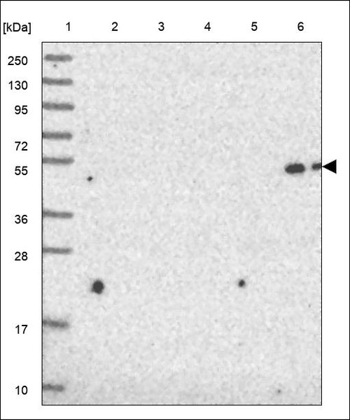 Lane 1: Marker [kDa] 250,130,95,72,55,36,28,17,10 Lane 2: RT4 Lane 3: U-251 MG Lane 4: Human Plasma Lane 5: Liver Lane 6: Tonsil