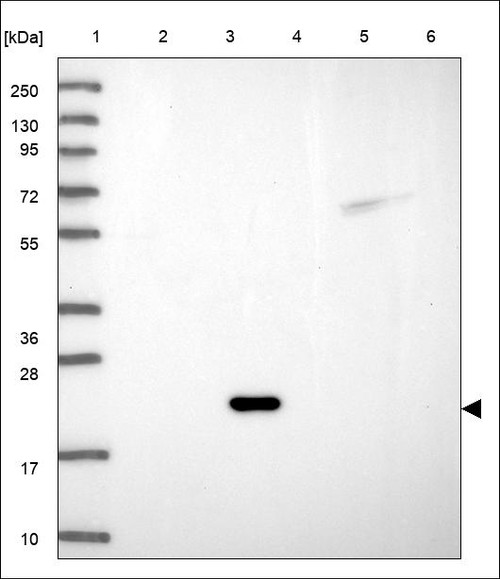 Lane 1: Marker [kDa] 250,130,95,72,55,36,28,17,10 Lane 2: RT4 Lane 3: U-251 MG Lane 4: Human Plasma Lane 5: Liver Lane 6: Tonsil