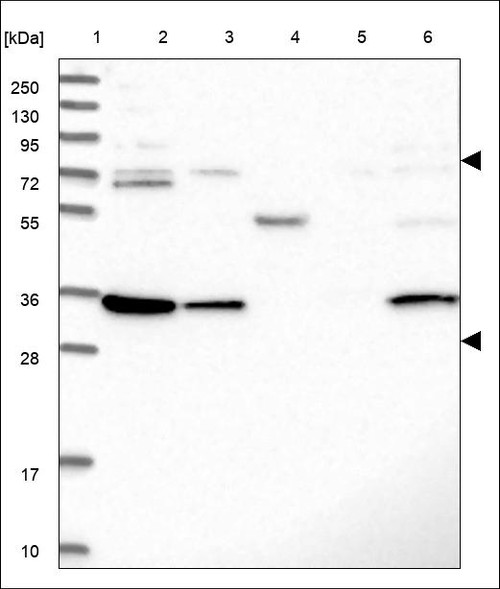 Lane 1: Marker [kDa] 250,130,95,72,55,36,28,17,10 Lane 2: RT4 Lane 3: U-251 MG Lane 4: Human Plasma Lane 5: Liver Lane 6: Tonsil