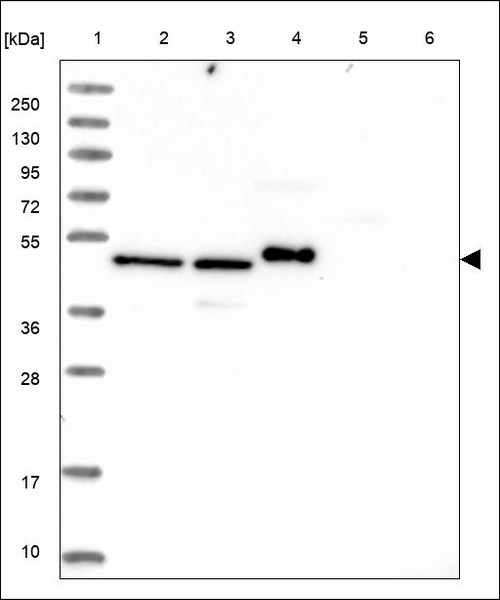 Lane 1: Marker [kDa] 250,130,95,72,55,36,28,17,10 Lane 2: RT4 Lane 3: U-251 MG Lane 4: Human Plasma Lane 5: Liver Lane 6: Tonsil