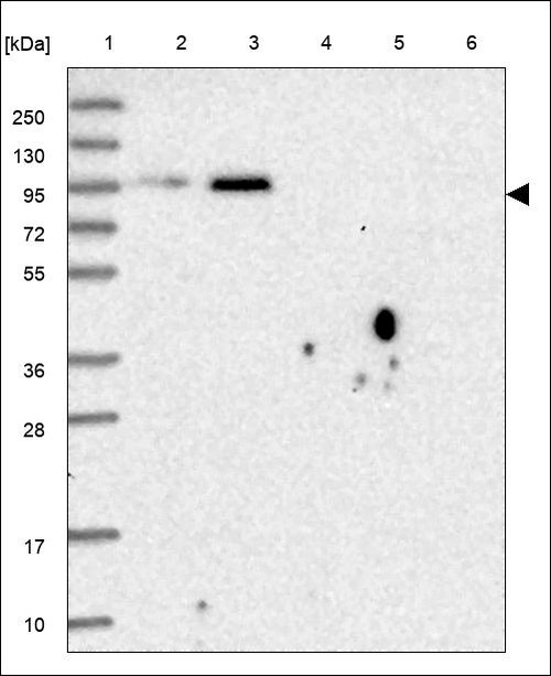 Lane 1: Marker [kDa] 250,130,95,72,55,36,28,17,10 Lane 2: RT4 Lane 3: U-251 MG Lane 4: Human Plasma Lane 5: Liver Lane 6: Tonsil