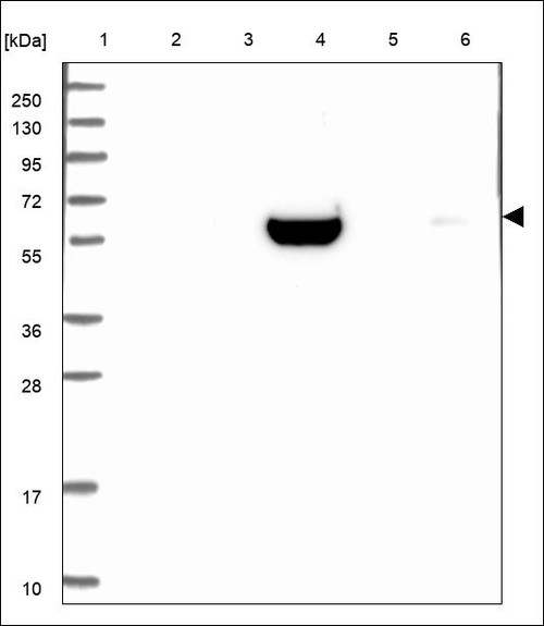 Lane 1: Marker [kDa] 250,130,95,72,55,36,28,17,10 Lane 2: RT4 Lane 3: U-251 MG Lane 4: Human Plasma Lane 5: Liver Lane 6: Tonsil
