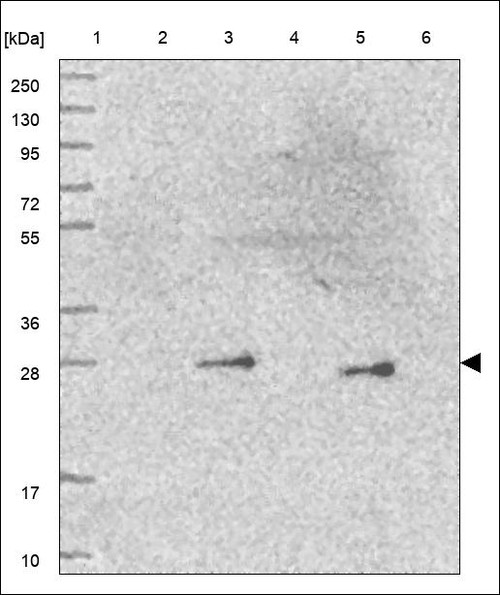 Lane 1: Marker [kDa] 250,130,95,72,55,36,28,17,10 Lane 2: RT4 Lane 3: U-251 MG Lane 4: Human Plasma Lane 5: Liver Lane 6: Tonsil