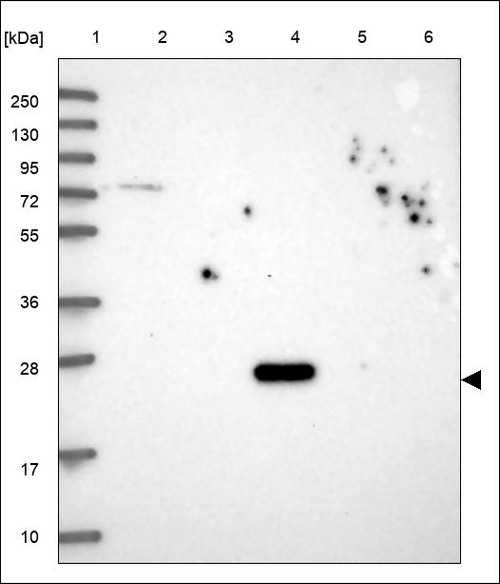 Lane 1: Marker [kDa] 250,130,95,72,55,36,28,17,10 Lane 2: RT4 Lane 3: U-251 MG Lane 4: Human Plasma Lane 5: Liver Lane 6: Tonsil