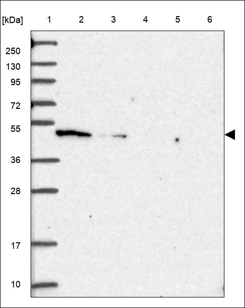 Lane 1: Marker [kDa] 250,130,95,72,55,36,28,17,10 Lane 2: RT4 Lane 3: U-251 MG Lane 4: Human Plasma Lane 5: Liver Lane 6: Tonsil