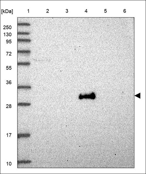 Lane 1: Marker [kDa] 250,130,95,72,55,36,28,17,10 Lane 2: RT4 Lane 3: U-251 MG Lane 4: Human Plasma Lane 5: Liver Lane 6: Tonsil