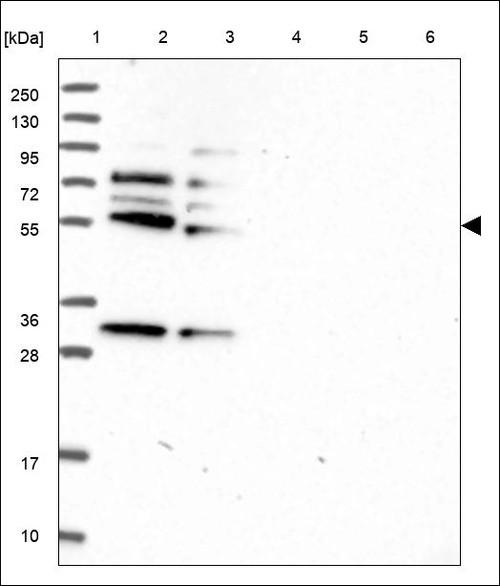 Lane 1: Marker [kDa] 250,130,95,72,55,36,28,17,10 Lane 2: RT4 Lane 3: U-251 MG Lane 4: Human Plasma Lane 5: Liver Lane 6: Tonsil