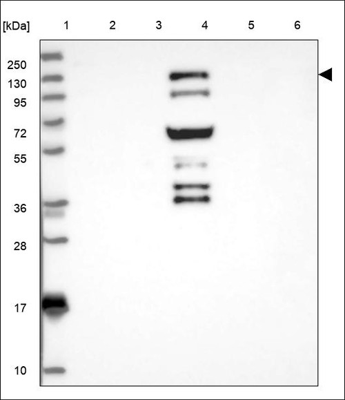 Lane 1: Marker [kDa] 250,130,95,72,55,36,28,17,10 Lane 2: RT4 Lane 3: U-251 MG Lane 4: Human Plasma Lane 5: Liver Lane 6: Tonsil