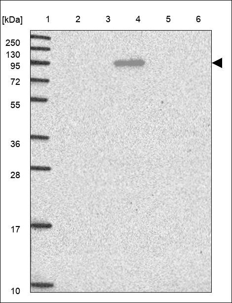 Lane 1: Marker [kDa] 250,130,95,72,55,36,28,17,10 Lane 2: RT4 Lane 3: U-251 MG Lane 4: Human Plasma Lane 5: Liver Lane 6: Tonsil