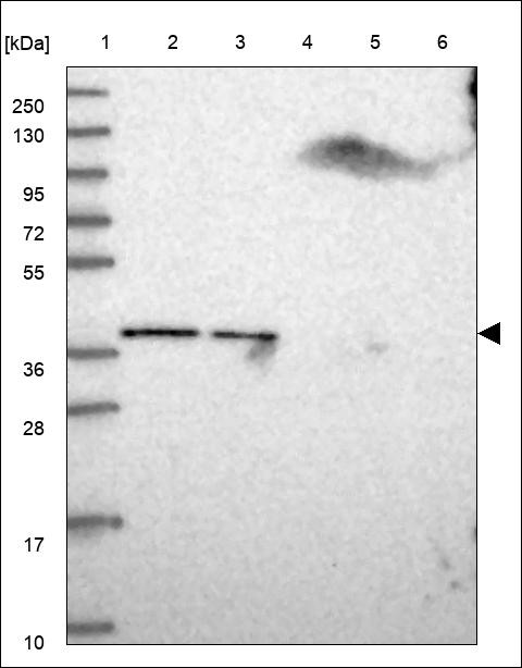 Lane 1: Marker [kDa] 250,130,95,72,55,36,28,17,10 Lane 2: RT4 Lane 3: U-251 MG Lane 4: Human Plasma Lane 5: Liver Lane 6: Tonsil
