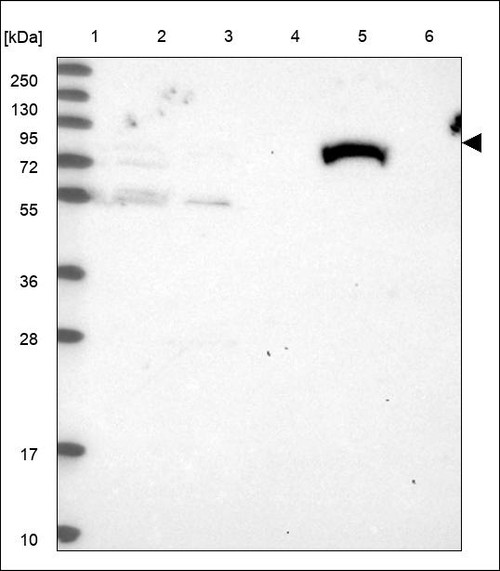 Lane 1: Marker [kDa] 250,130,95,72,55,36,28,17,10 Lane 2: RT4 Lane 3: U-251 MG Lane 4: Human Plasma Lane 5: Liver Lane 6: Tonsil