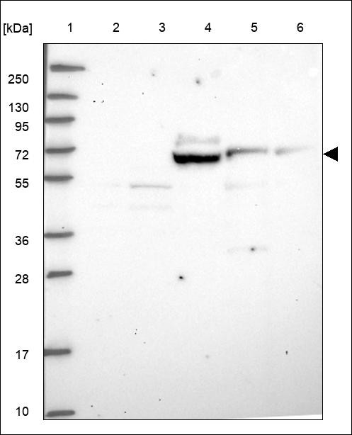 Lane 1: Marker [kDa] 250,130,95,72,55,36,28,17,10 Lane 2: RT4 Lane 3: U-251 MG Lane 4: Human Plasma Lane 5: Liver Lane 6: Tonsil