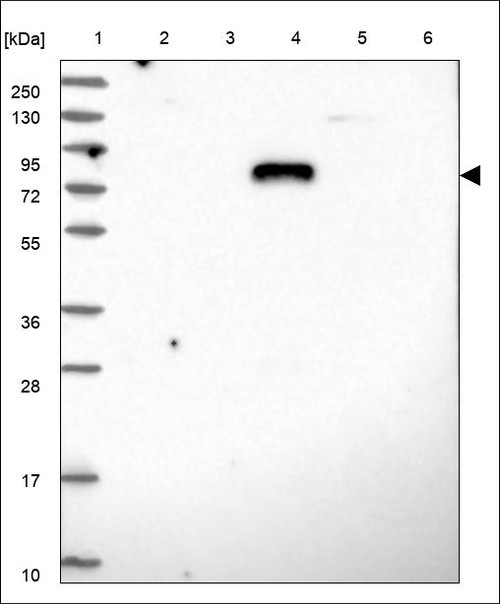 Lane 1: Marker [kDa] 250,130,95,72,55,36,28,17,10 Lane 2: RT4 Lane 3: U-251 MG Lane 4: Human Plasma Lane 5: Liver Lane 6: Tonsil