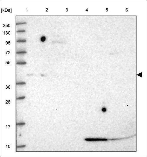Lane 1: Marker [kDa] 250,130,95,72,55,36,28,17,10 Lane 2: RT4 Lane 3: U-251 MG Lane 4: Human Plasma Lane 5: Liver Lane 6: Tonsil