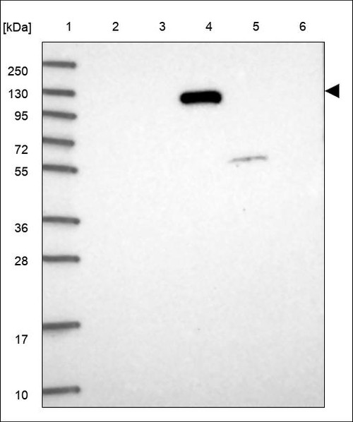 Lane 1: Marker [kDa] 250,130,95,72,55,36,28,17,10 Lane 2: RT4 Lane 3: U-251 MG Lane 4: Human Plasma Lane 5: Liver Lane 6: Tonsil