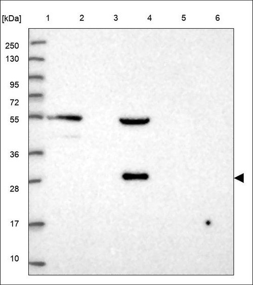 Lane 1: Marker [kDa] 250,130,95,72,55,36,28,17,10 Lane 2: RT4 Lane 3: U-251 MG Lane 4: Human Plasma Lane 5: Liver Lane 6: Tonsil