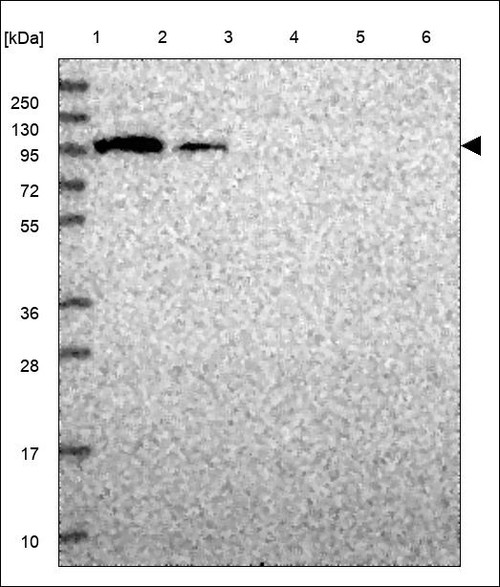 Lane 1: Marker [kDa] 250,130,95,72,55,36,28,17,10 Lane 2: RT4 Lane 3: U-251 MG Lane 4: Human Plasma Lane 5: Liver Lane 6: Tonsil