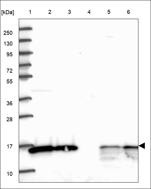 Lane 1: Marker [kDa] 250,130,95,72,55,36,28,17,10 Lane 2: RT4 Lane 3: U-251 MG Lane 4: Human Plasma Lane 5: Liver Lane 6: Tonsil
