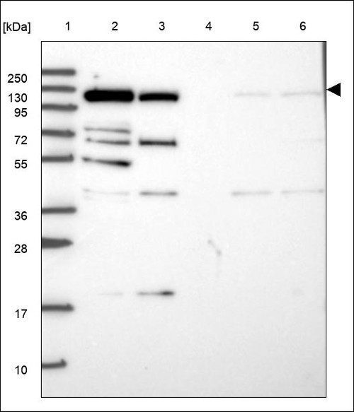 Lane 1: Marker [kDa] 250,130,95,72,55,36,28,17,10 Lane 2: RT4 Lane 3: U-251 MG Lane 4: Human Plasma Lane 5: Liver Lane 6: Tonsil