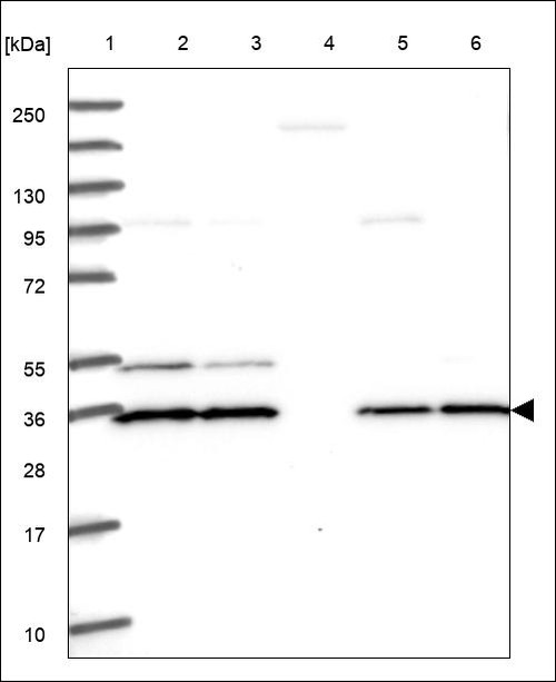 Lane 1: Marker [kDa] 250,130,95,72,55,36,28,17,10 Lane 2: RT4 Lane 3: U-251 MG Lane 4: Human Plasma Lane 5: Liver Lane 6: Tonsil