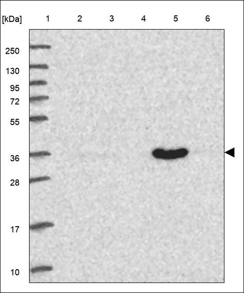 Lane 1: Marker [kDa] 250,130,95,72,55,36,28,17,10 Lane 2: RT4 Lane 3: U-251 MG Lane 4: Human Plasma Lane 5: Liver Lane 6: Tonsil
