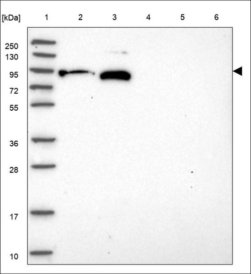 Lane 1: Marker [kDa] 250,130,95,72,55,36,28,17,10 Lane 2: RT4 Lane 3: U-251 MG Lane 4: Human Plasma Lane 5: Liver Lane 6: Tonsil