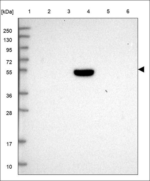 Lane 1: Marker [kDa] 250,130,95,72,55,36,28,17,10 Lane 2: RT4 Lane 3: U-251 MG Lane 4: Human Plasma Lane 5: Liver Lane 6: Tonsil