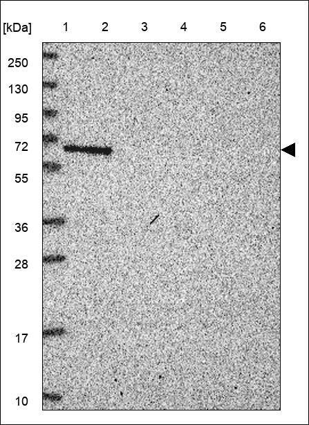 Lane 1: Marker [kDa] 250,130,95,72,55,36,28,17,10 Lane 2: RT4 Lane 3: U-251 MG Lane 4: Human Plasma Lane 5: Liver Lane 6: Tonsil